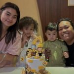 Cesen Eks JKT48 Jalani Operasi Tulang Ekor Setelah 8 Tahun Menahan Sakit Akibat Cedera